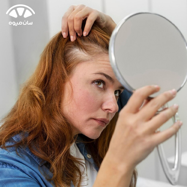 برای جلوگیری از ریزش مو چه ویتامینی بخوریم؟